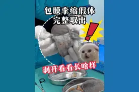 包膜挛缩假体完整取出，剥开看看长啥样！ #抖出健康知识宝藏  #包膜挛缩 #手术室日常 #假体取出 #胸假体视频封面