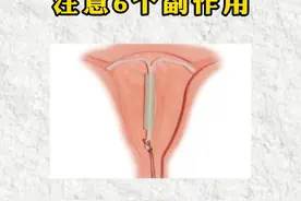 子宫腺肌症上曼月乐环，要注意6个副作用！ #腺肌症 #曼月乐 #副作用 #女性健康视频封面