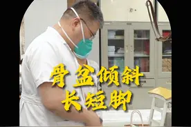 门诊中多数长短腿问题是由于骨盆倾斜有关~ #长短腿 #骨盆倾斜 #健康守护计划 #朱烱伟 #三部正骨法视频封面