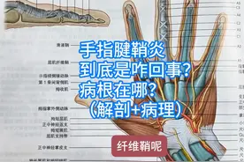 手指腱鞘炎，到底是咋回事？病根在哪？（解剖+病理）视频封面