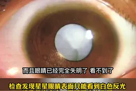 8岁孩子黑眼珠变“白”，险些完全失明，医生提醒：这类孩子尽早检查！ 视频封面