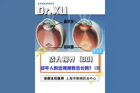 一些眼部疾病也会导致成年人出现近视或近视度数的增加！#白内障  #青光眼  #眼外伤  #眼健康光明计划 #成年人近视度数还会加深吗视频封面