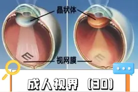 一些眼部疾病也会导致成年人出现近视或近视度数的增加！#白内障  #青光眼  #眼外伤  #眼健康光明计划 #成年人近视度数还会加深吗视频封面