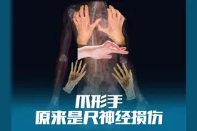 爪形手，原来是尺神经损伤形成的 臂丛：尺神经位置与功
#解剖学视频封面
