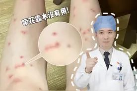 这不是蚊子包，而是虫咬皮炎！！千万别挠！#蚊子包 #虫咬皮炎 #科普 #蚊子叮咬 #抖出健康知识宝藏