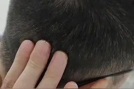 后脑勺的突起是病吗？#枕外隆突 #颅骨 #头痛 #反骨 #三国视频封面