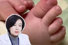 几个月的宝宝也会得甲沟炎?只要指甲剪错就很容易得！ 医生30秒教你处理~
#甲沟炎 #修脚 #嵌甲 #冷知识 #抖出健康知识宝藏视频封面