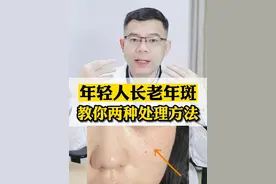 年纪轻轻长老年斑，想要去掉，医生给你支招。#老年斑 #祛斑#美白#医学科普