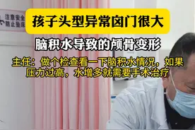 脑积水导致孩子头型出现异常，一定要尽早治疗！ #医学科普 #脑积水 #头型异常 #头型