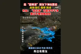 趁“蓝眼泪”下海玩耍后，朋友皮肤发红、瘙痒、脱皮！钓友：#建议不要让蓝眼泪接触皮肤  （记者：屠晨潇）@A凱不打亀🎣视频封面