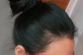 让我们一起祝丹丹，早日康复！#缘梦计划 #BRTV生命缘 #援助重病家庭 #生活不易爱心传递视频封面