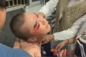 7月24日浙江丽水，一名婺剧演员中暑后仍坚持演出，下台后浑身瘫软，抓痧半小时后才有所缓解。当事人丁先生表示：“我是主演，坚决不能停”#婺剧#文化传承 