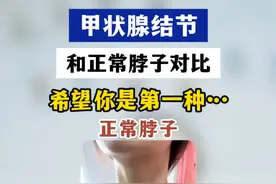 #热点 #甲状腺结节