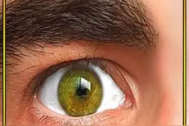 最罕见的9种身体特征 #纪录片 #头条视频创作激励计划第3期 #头条双星激励计划 #罕见的人体特征视频封面