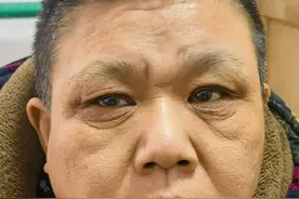 沈阳市寻亲：中年女子被救助，灰白头发，高1米5左右图片