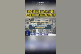 #猴痘通过这些方式传播  #12国家和地区已发现病例