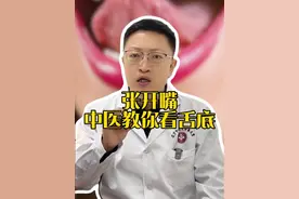 张开嘴，中医教你看舌底 #医疗健康创作训练营 #硬核健康科普行动 #舌诊 #中医 #养生