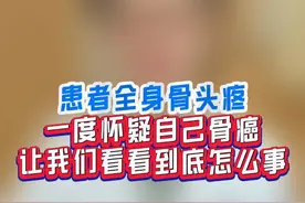 全身骨头疼？到底咋回事 #骨质疏松 #骨头疼 #硬核健康科普行动视频封面