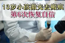 13岁小孩激光去瘢痕，第6次恢复自信。 #医学科普 #让我们一起变美 #瘢痕 #瘢痕修复视频封面
