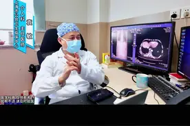 甲状腺结节超声报告TI-RADS分类如何看是良性还是恶性#介入科袁敏视频封面