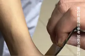 压力大 爱生气 甲状腺有结节？！中医手把手教你刮手臂 “每天刮1~2次 每次3~5分钟”#媒体精选计划视频封面