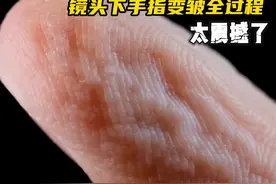 手指变皱全过程，为什么手指泡水会变得皱巴巴？ #科普一下视频封面