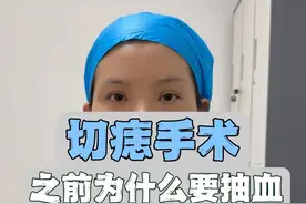 切痣手术之前为什么要抽血 #痣 #色素痣 #切痣 #抽血 #医学科普视频封面