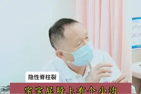 宝宝屁股上有个小沟，孕期叶酸服用不够导致的#叶酸 #隐性脊柱裂 #育儿 #我的门诊故事 #硬核健康科普行动视频封面