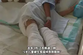 推下楼梯、逼吃大便、长期挨饿……5岁男童被生母虐待致双腿截肢、双眼一级残疾，其生母一审被判6年9个月。#5岁男童被生母虐待致双腿截肢视频封面