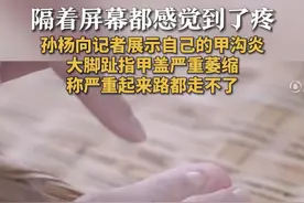 【隔着屏幕都感觉到了疼！孙杨向记者展示自己的甲沟炎，大脚趾指甲盖严重萎缩，称严重起来路都走不了】
近日，孙杨在一档节目中谈到自己的甲沟炎。孙杨说很多人觉得甲沟炎其实是个很小的事情，但疼起来真的要命。指甲跟水面打水接触的时候，是非常痛的。