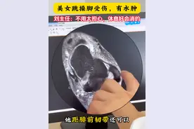 美女跳操脚受伤，有水肿 #运动康复 #医学科普 #硬核健康科普行动视频封面