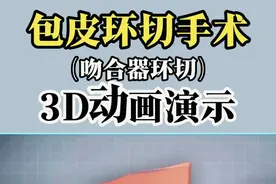 包皮环切术，3D动画演示！ #硬核健康科普行动   #科普一下  #包皮  #听医生一句劝  #医疗健康创作训练营视频封面