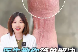 女生手上干燥起皮，这是天生“公主命”！#湿疹#家庭主妇#情侣#角化型湿疹#科普视频封面