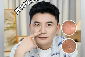 网络去黑头方法大赏，要想黑头少，这期视频反复观看 #黑头#护肤#皮肤管理#护肤分享#干货分享视频封面