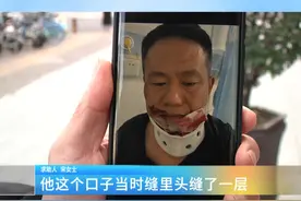 因车祸受伤，保险该怎么理赔？这里有标准！
亚太财险：按国家标准标赔付，如有异议，可提供证明 会调改金额#车祸 #保险理赔 #赔付标准视频封面