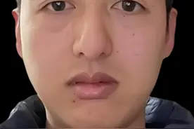 金鱼眼带血丝，面相会有血光之灾吗？ #看相视频封面