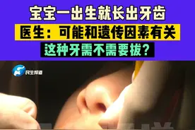 9月10日（发布）河南郑州，宝宝一出生就长出牙齿，医生：可能和遗传因素有关，这种牙需不需要拔？#河南dou知道 #拔牙视频封面