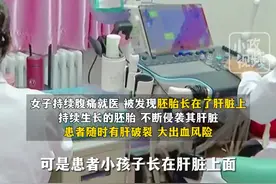 11月15日（发布），福建福州。罕见！胎儿竟在肝脏上生长。医生：全球报道不超过50例。关注@小政视频 #福建dou知道 #妊娠 #万万没想到 #异位妊娠 （来源：@第一帮帮团）视频封面