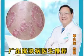 银屑病初期有哪些症状表现？ #广东银屑病医生推荐 #单孔荣医生 #广东银屑病 #挂单孔荣号 #硬核健康科普行动视频封面