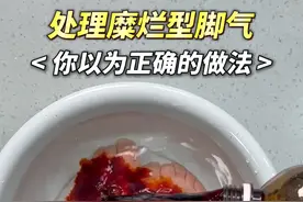 不要再乱治#脚气 了，医生手把手教你正确处理！#糜烂型脚气 #传染 #咪康唑散 #硬核健康科普行动