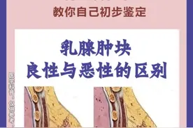 乳腺科主任教你自己区别肿块的良性恶性 #乳腺肿块 #乳腺结节 #自查自检 #乳腺外科刘锦平 #抖音知识年终大赏 @抖音短视频