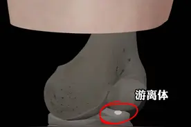 膝关节游离体取出术 3D动画演示 #膝关节 #骨科 #膝盖保护 #硬核健康科普行动 #医疗健康创作训练营视频封面
