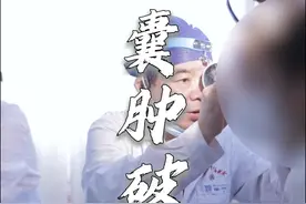 “囊肿破裂”了，不要慌。#囊肿 #门诊日常 #门诊故事 #门诊 #医生视频封面