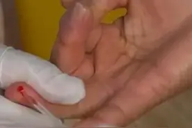 #我国艾滋病98以上为性传播  #我国艾滋病性传播约70是异性传播  #我国艾滋病性传播危险行为有所减少