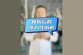 注意⚠️骨折后的张力水疱～ #骨折 #老茂谈骨