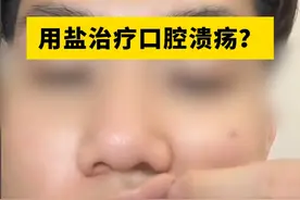 #口腔溃疡 特别疼，别再用盐撒了，医生分享一个简单实用的小方法#科普 #医学科普 #生活小常识 #涨知识视频封面