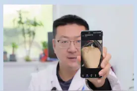 肩背部瘢痕疙瘩，干预两次恢复不难 #疤痕疙瘩 #疤痕增生 #疤痕 #疤痕体质 #瘢痕疙瘩怎么去除视频封面