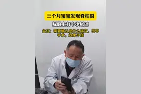 三个月宝宝屁股上有个小尾巴，这是隐性脊柱裂！需要尽早手术 #医学科普 #脊柱裂 #隐性脊柱裂 #门诊日常视频封面