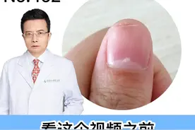 观察一下自己的手指甲，有没有这些情况，有可能是身体在求救！#指甲 #健康科普 #指甲竖纹 视频封面