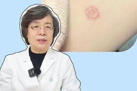 身上长红色斑片，可能是这两种皮肤病，要分情况治疗！ #体癣 #玫瑰糠疹 #医学科普 #皮肤 #抖出健康知识宝藏视频封面